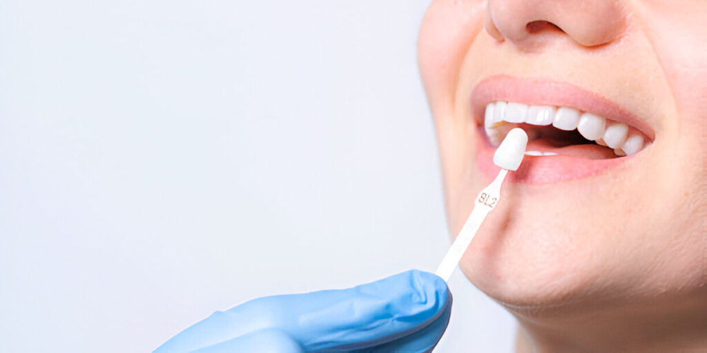 Smile Makeover: The Role of Cosmetic Dentistry in Oral Health_2